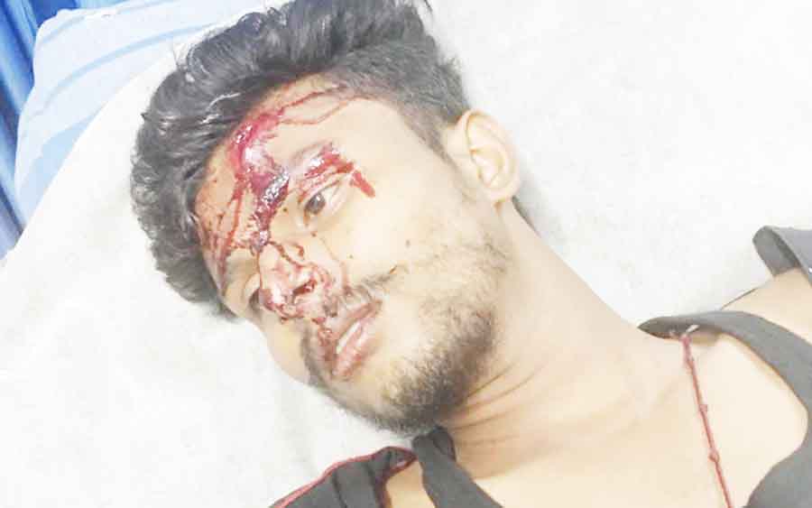 കുറുന്തൂർ സംഘർഷം: സിപിഎം-ബിജെപി പ്രവർത്തകർക്കെതിരെ നരഹത്യാശ്രമത്തിന് കേസ്